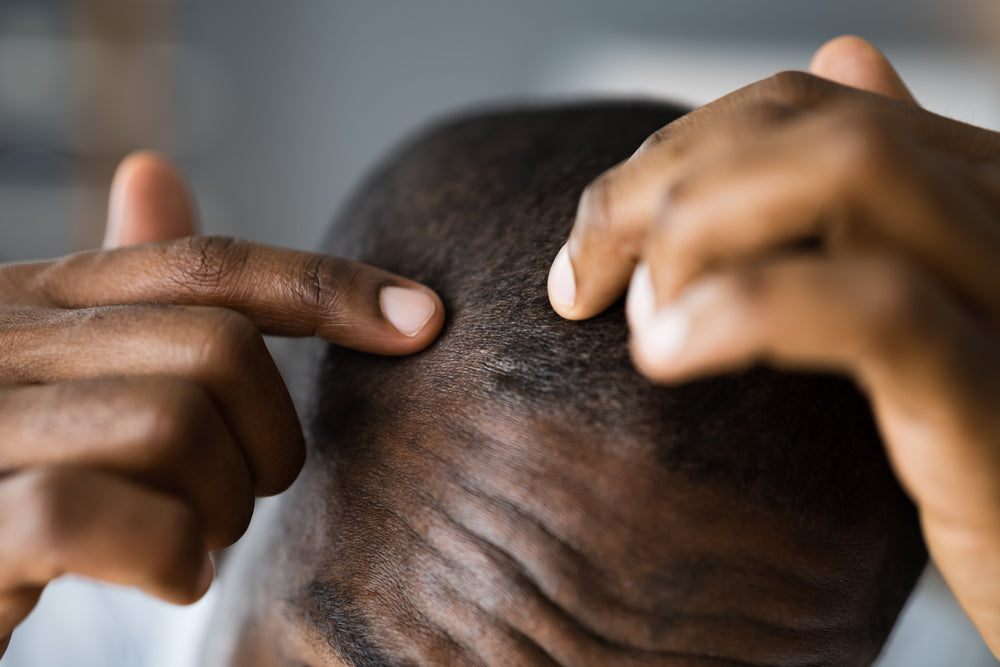 Top 5 Tips for Males Caring For Thin Hair Over 50